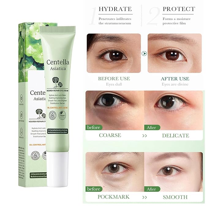 Centella Asiatica Eye Cream,Moisturizes and Tightens the Skin Around the Eyes,Reduces Dry Lines and Fine Lines,Improves Dark Circles Under the Eyes,Lightweight Refreshing,Non Greasy