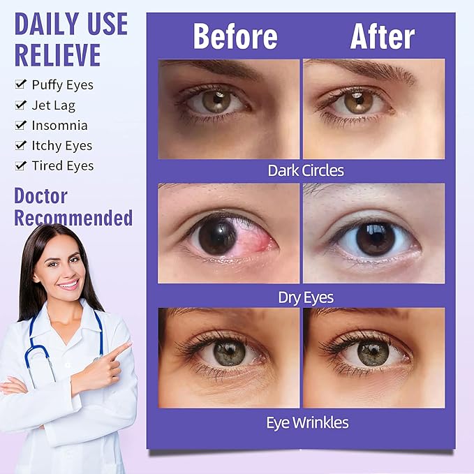 Serfeymi 22 Packs Steam Eye Mask-Disposable Cornea Care Rest Self Heating Eye Mask,Warm Eye Compresses for Dry Eyes,Sleep,Spa,Travel Essentials & Relaxation Gifts,Stocking Stuffers-Lavender