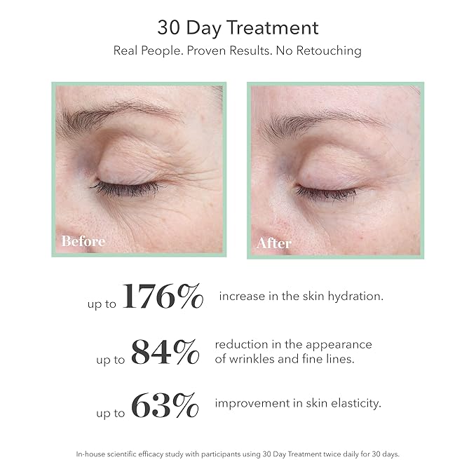 BIOEFFECT 30 Day Anti-Aging Treatment for Face and Neck With 3 Plant Based EGF Growth Factors & Hyaluronic Acid, Hydrating, Wrinkle-Fighting Firming Facial Serum