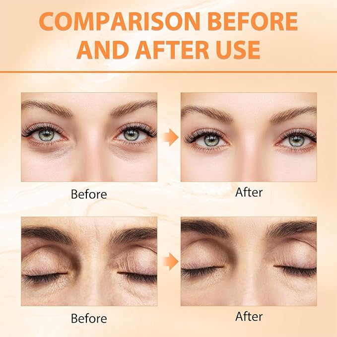 Revive Glow Vitamin C Eye Balm, Hydrating Eye Cream,Improve Dark Circles,Brightens Skin Tone,Reduces Puffiness(2PCS)