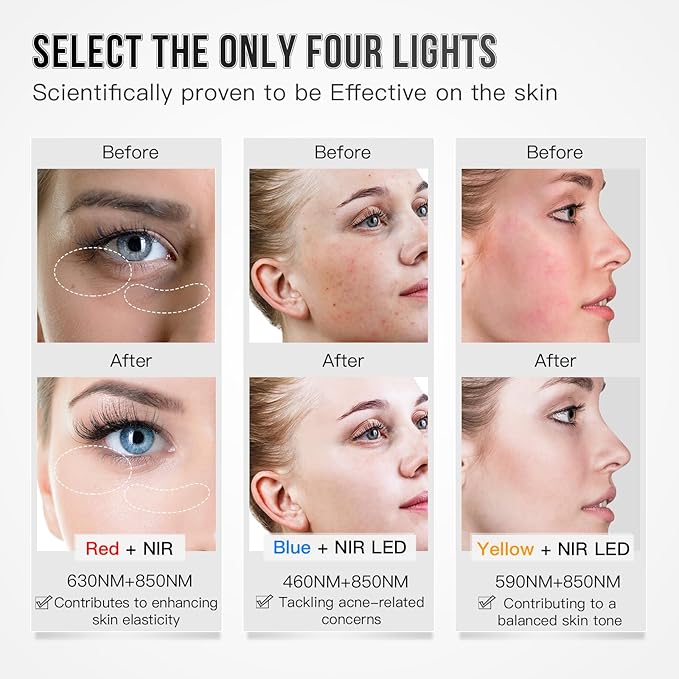 Led Face Mask Light Therapy, Red Light Therapy For Face, 3 Colors LED Skin Mask With Near infrared light, Skincare Device for All Skin Types at Home (White)