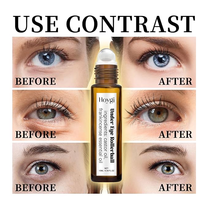 Eye Roller for Puffy Eyes, Castor Oil and Frankincense Eye Roller for Dark Circles, and Wrinkles, Anti Aging Eye Serum Cream, Glass Bottle, 2 PCS