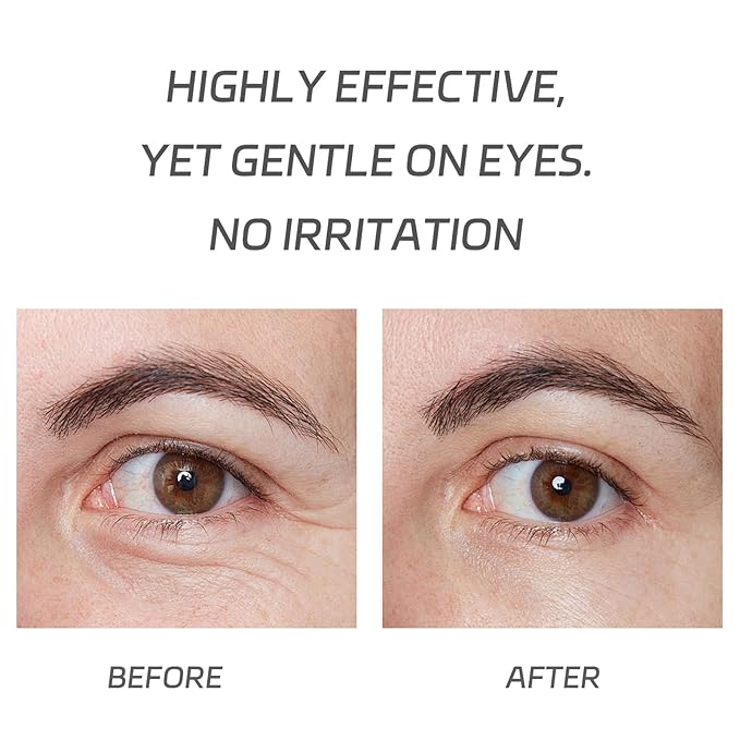 VGO Vitamin C Vitamin E Facial Serum 2.02oz + Eye Repair Cream for Dark Circles & Puffiness 0.5oz