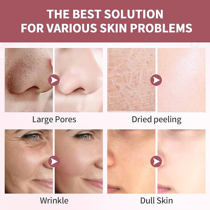 Bio-Collagen Face Masks, Real Deep Collagen Mask, Vitality-Fill Deep Hydrates, Facial Hydrogel Masks | TikTok Trend Items | Korean Skin Care