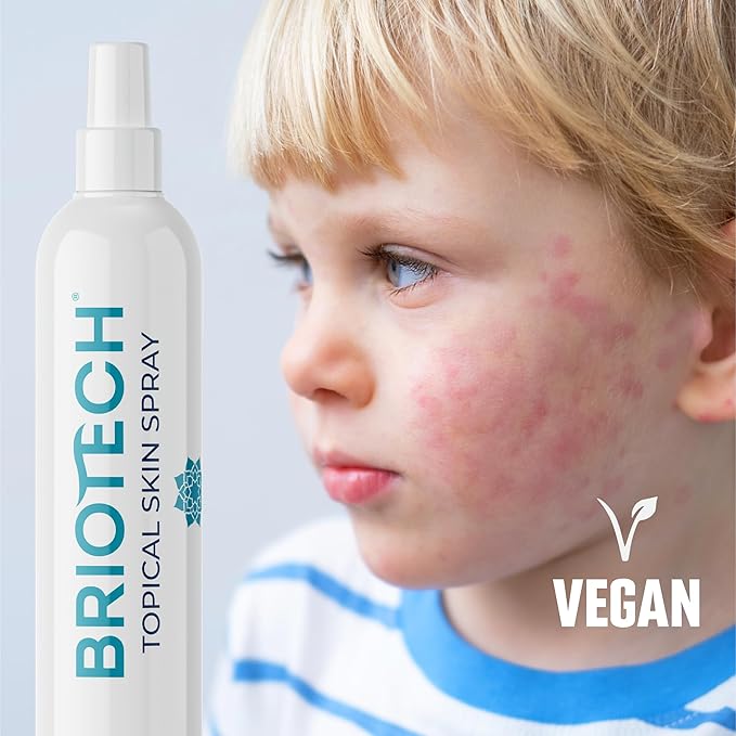 BRIOTECH Topical Skin Spray, Hypochlorous Acid Spray for Body & Face, HOCl Facial Mist, Support Against Irritation, Redness, Packaging May Vary, 4 oz ea, 2 ct