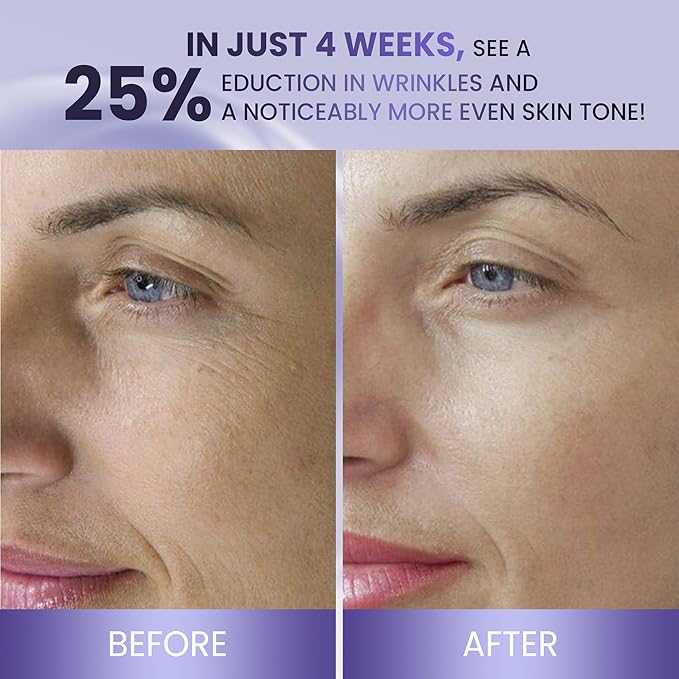 ABERA BELANI Retinol Night Cream For Women, Dark Spot Remover, Melasma Treatment, Reduce Fine Lines, Anti-Wrinkle, Anti-Aging Neck and Décolleté For Face (1 Box + Gift Eyelash Serum)