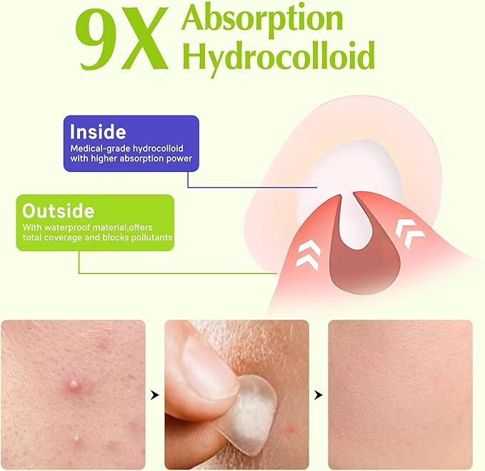 Pimple Patches for Face, Invisible Hydrocolloid Acne Patches Acne Treatment,Covering Zits & Blemishes in Skin and Face, Zit Patches with Salicylic Acid, FSA HSA Store Eligible Items 120 Count