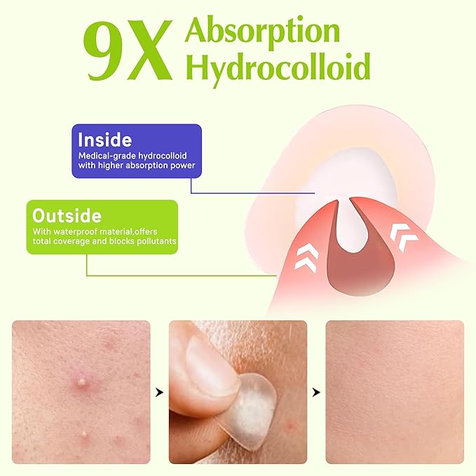 Pimple Patches For Face, Invisible Hydrocolloid Acne Patches Acne Treatment,Covering Zits & Blemishes in Skin and Face, Zit Patches with Salicylic Acid, FSA HSA Store Eligible Items 48 Count