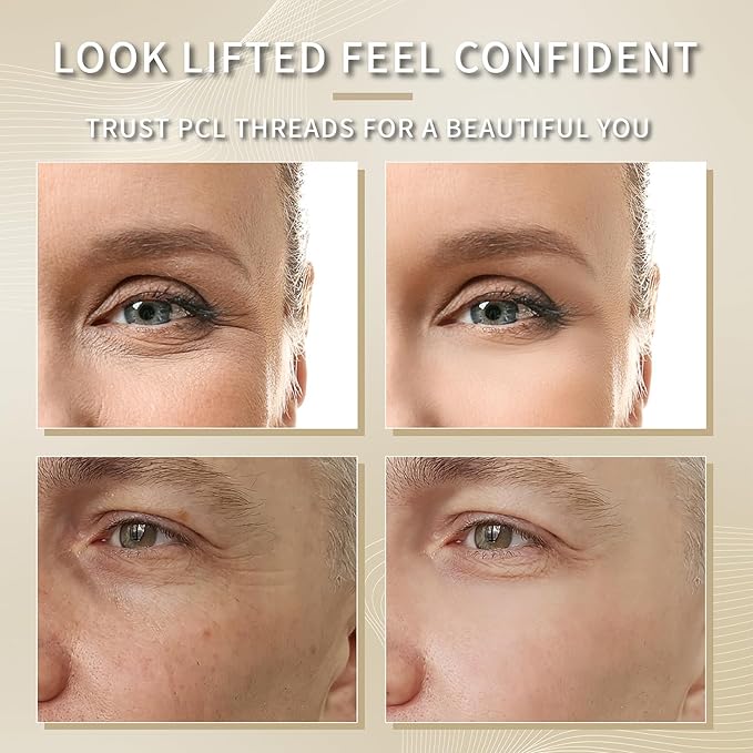 elves PCL Threads for Face Lift Mono Threads 26G60mm Pcl Smooth Threads Sharp Tip PCL Threads Mono 20Pcs Long-Lasting Skin Tightening Smoothing of Wrinkles