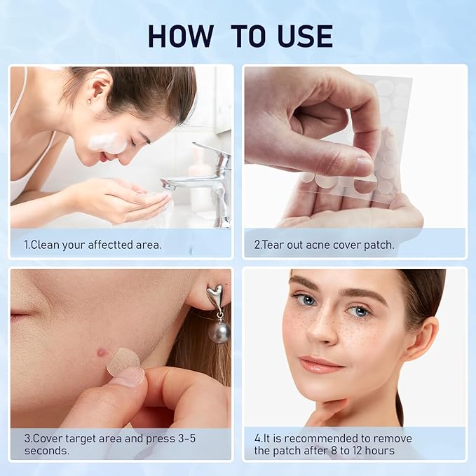 Pimple Patches for Face, 3 Sizes 288 Counts Acne Patches, Hydrocolloid Patches Zit Patches for Skin Care, Blemish Patches Invisible Acne Spot Treatment with Salicylic Acid, Tea Tree Oil