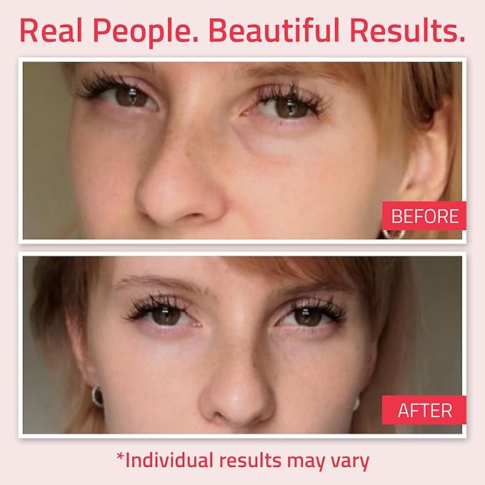 YEOUTH Retinol Eye Cream, Firming Under Eye Cream for Puffiness and Bags Under Eyes for Wrinkles and Dark Circles with Hyaluronic Acid and Tripeptides 2oz