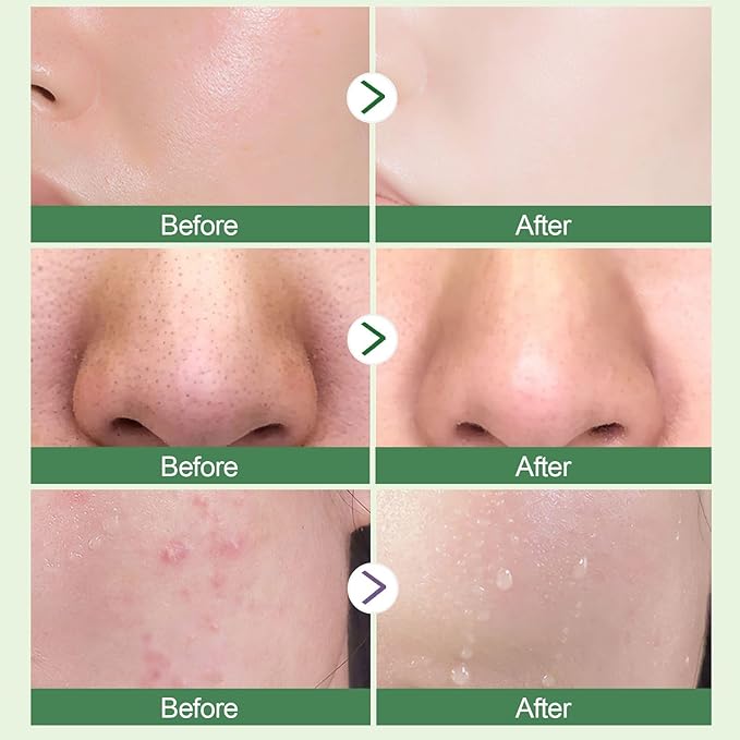 2 PCS Green Tea Purifying Clay Face Mask, Blackhead Remover With Green Tea Extract, Face Moisturizing，Deep Pore Cleansing for All Skin Types of Men And Women