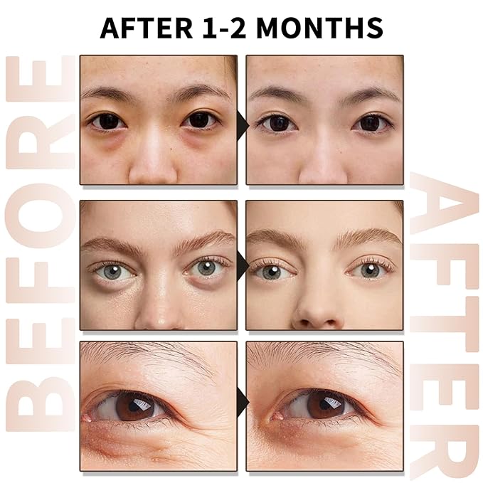 Caffeine Eye Serum With EGCG For Dark Circles and Puffiness, Anti Aging 5% Caffeine Solution For Puffy Eyes, Fine Lines, Moisturizing Under Eye Serum, 2PCS.