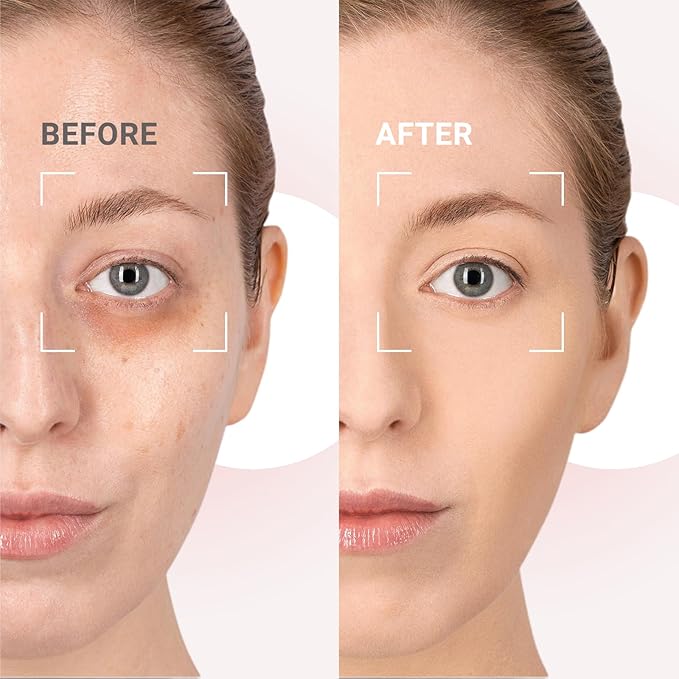 Caffeine Eye Cream for Dark Circles and Puffiness,Under Eye Cream for Fine Lines Wrinkles and Bags,Eye Care Eye Roller Serum with 360° Massage Ball