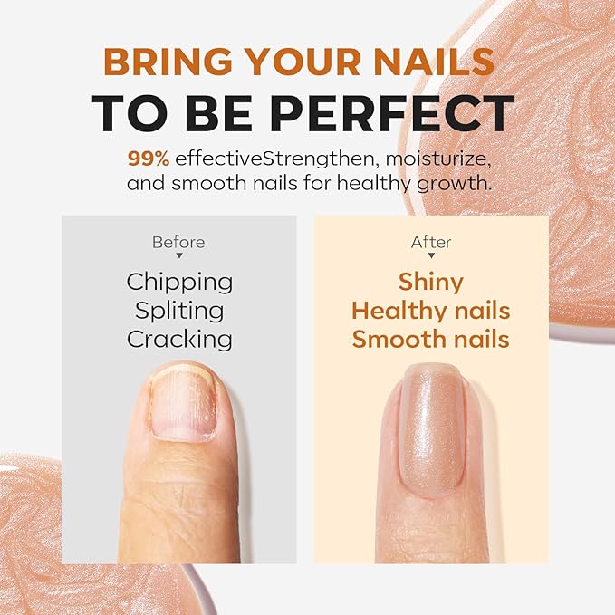 modelones Nail Strengthener, 8-in-One Nail Ridge Filler Base Coat Nail Polish Repair Nail Growth Treatment for Thin and Damaged Nails, Sparkling Champagne, 15ml