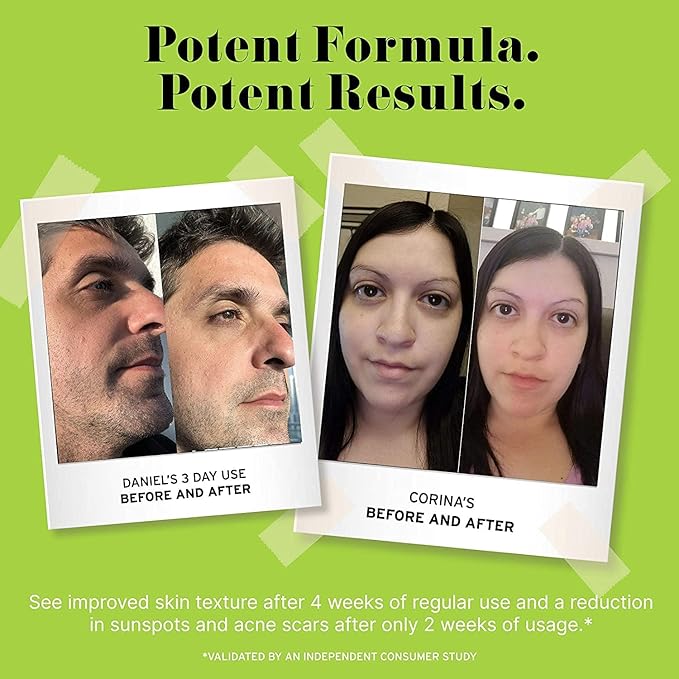 No Bad Stuff - Caffeine Eye Cream with Pure Hyaluronic Acid & Plant Based Squalane Oil, Under Eye Cream for Dark Circles & Puffiness, Gluten Free, Vegan, Travel Size, 0.5 FL Oz