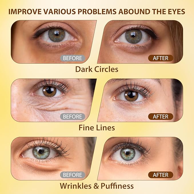 Soulight 5% Caffeine Eye Serum for Anti Aging | Reduce Dark Circles, Puffiness, Fine Lines & Wrinkles | Hyaluronic Acid & Niacinamide Moisturizer with 360° Massage Ball | Eye Balm for Men & Women