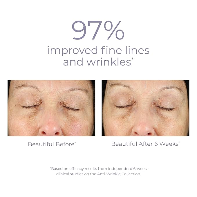 Derma E Anti-Wrinkle Renewal Skin Cream – Vitamin A Wrinkle Treatment Cream, 4 oz, + Anti-Aging Regenerative Night Cream – Firming Astaxanthin Moisturizer for Face, 2 oz