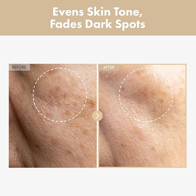 Rice Glow Milky Toner with 784,000ppm Korean Rice Water, Niacinamide, Ceramides, Panthenol, Glow, Glass Skin, Hydrating, Purifying, Fragrance-Free, Korean Skin Care, 250ml, 8.45 fl.oz.