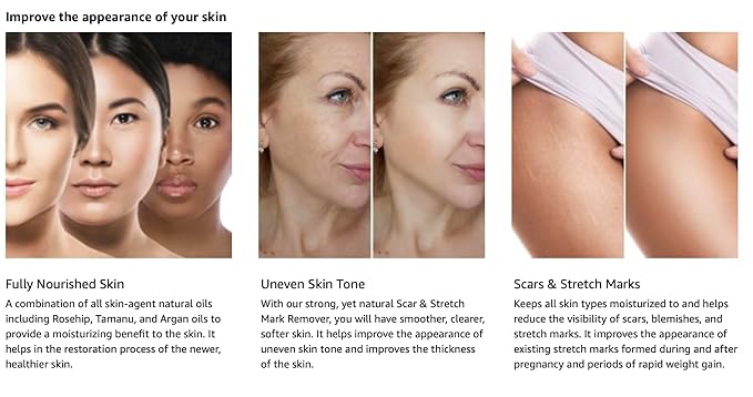 KOKOS Organic face and body oil, scar, stretch mark,Rosehip, Wheat Germ, Argan, Tamanu, Carrot, Rosemary, Lavender, Geranium, Patchouli, Sage oil