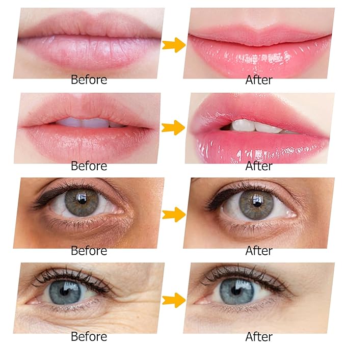 40 Pairs Pink Lip Masks & Eye Masks, 24K Gold Gel Collagen Eye Patches for Puffy Eyes, Dark Circles, Wrinkles and Eye Bags, Moisturizing Crystal Mask Set for Women Men