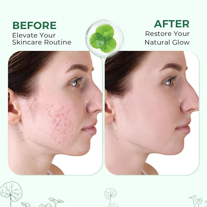 Centella Serum, Face Hydrating Fermented Centella Asiatica Serum, Soothing, Barrier Repair, Firming, Revitalize Glowing Centella Ampoule Facial Moisturizer with Ceramide NP, for All Skin (50ml)