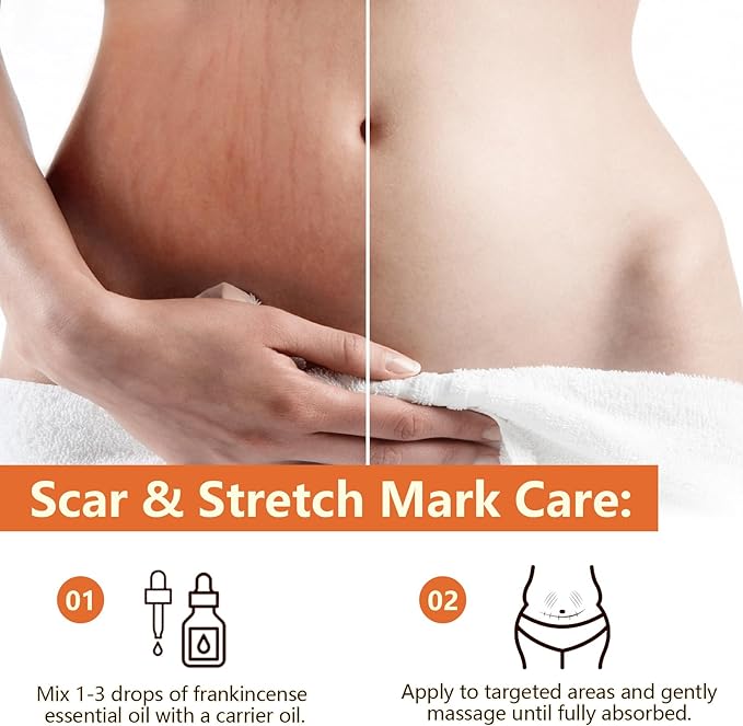 Premium Frankincense Essential Oil – 100% Pure & Natural, Therapeutic Grade for Skin, Face & Aromatherapy | Best Frankincense Oil for Face, Wrinkles & Scars | Deeply Nourishing