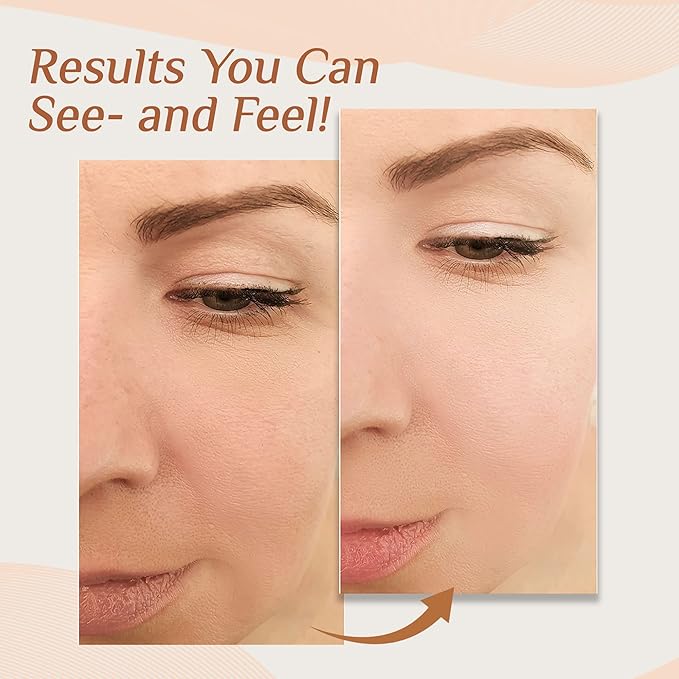 Vivo Per Lei Hyaluronic Acid Day Cream and Retinol Night Cream Combo - Skin Care Set for Women - 1.76 Oz / 50 G