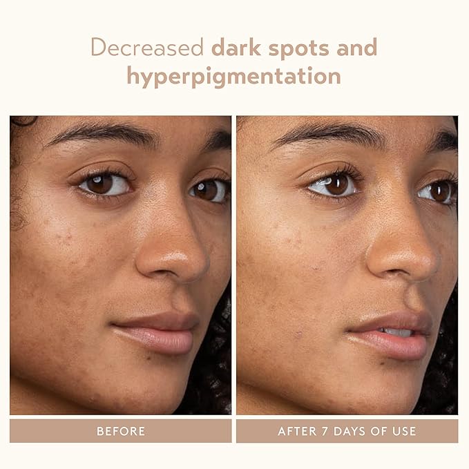 SHANI DARDEN SKIN CARE Lactic Acid Face Serum, Active Night Serum to Help with the Look of Radiant and Smooth Skin, Gentle But Powerful Face Exfoliator, 1.01 fl oz