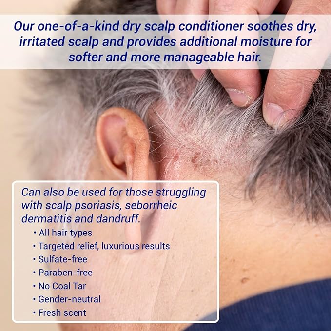 TriDerma Dry Scalp Control Deep Moisturizing Hair Conditioner - Salon Quality Treatment - Salicylic Acid, Exfoliates, Nourishes & Strengthens Hair - Exotic Mongongo & Rosemary Oil - 6 oz