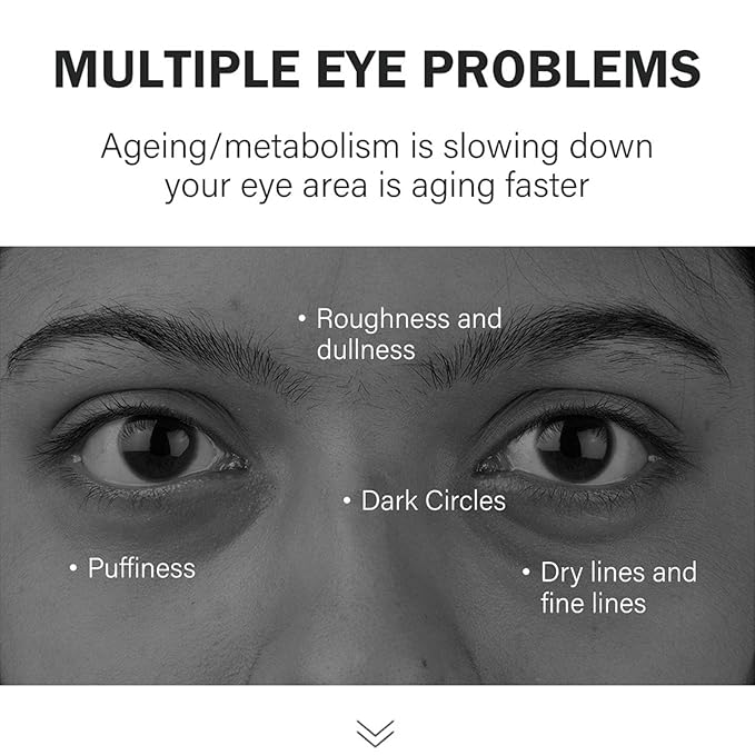 Retinol Under Eye Balm Stick, Anti-Aging Retinol Eye Stick for Dark Circles and Puffiness, Smooth Wrinkle Fine Lines, Firm Skin, Non Greasy, Hydrating and Nourish on the Skin Around the Eyes