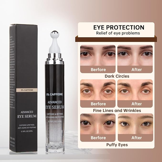 Caffeine Eye Cream for Puffiness & Dark Circles, Under Eye Cream for Puffy Eyes, Eye Bags & Wrinkles, 1 PCS Anti Aging Eye Serum with Under Eye Roller, Reduces Fine Lines & Moisturize Skin.