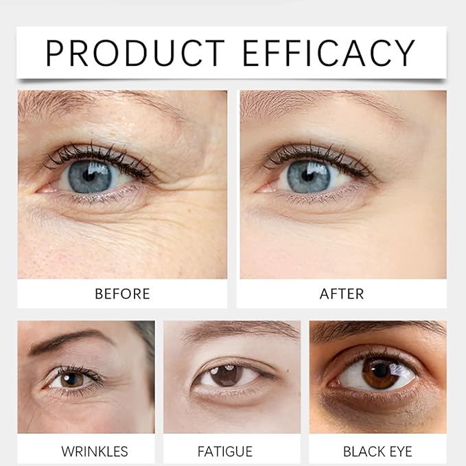 Dinkiss Lutein Eye Essence Oil, Vitamin C Lutein Eye Essence Oil, Improve Bags and Dark Circles, for Women Men (1, 2 pcs)