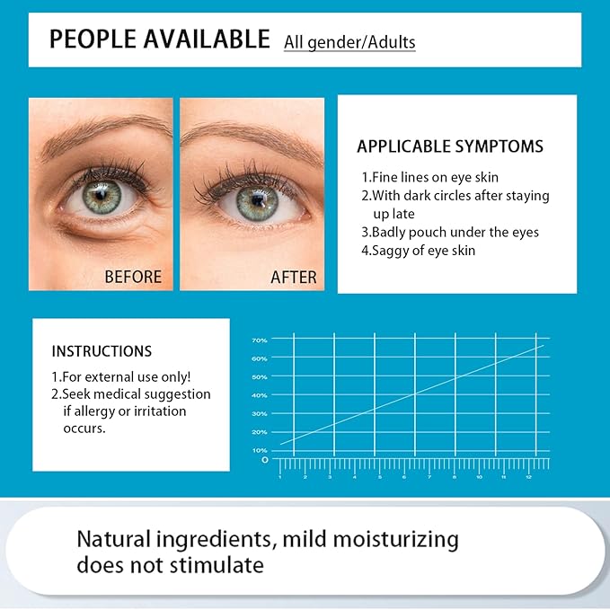 Eye Mask, 30 Pairs Collagen Under Eye Patches, Black Crystal Eye Gel Pads for Reducing Dark Circles, Lighten Wrinkles Anti-Aging Moisturizing, Fine Lines Eye Bags Puffiness Women Men