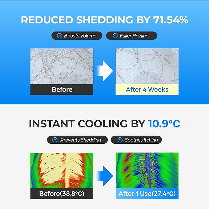 Scalpy Hair Growth Serum for Hair Loss & Thinning | Mothers Day Gifts for Mom | Scalp Massager Treatment w/Salicylic Acid, Menthol, Dexpanthenol | Non-Greasy, Lightweight | Exfoliate Dandruff