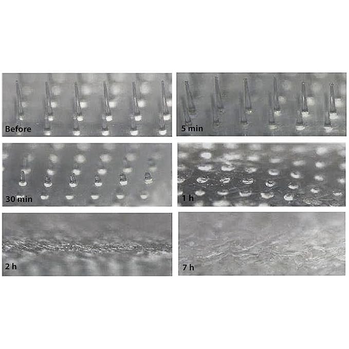 Frilliance Microdart Hydrocolloid Acne Pimple Patches for Zits and Blemishes (4 count) Spot Treatment Stickers for Face & Skin, Vegan and Cruelty Free (Deep Dive Micro Darts)