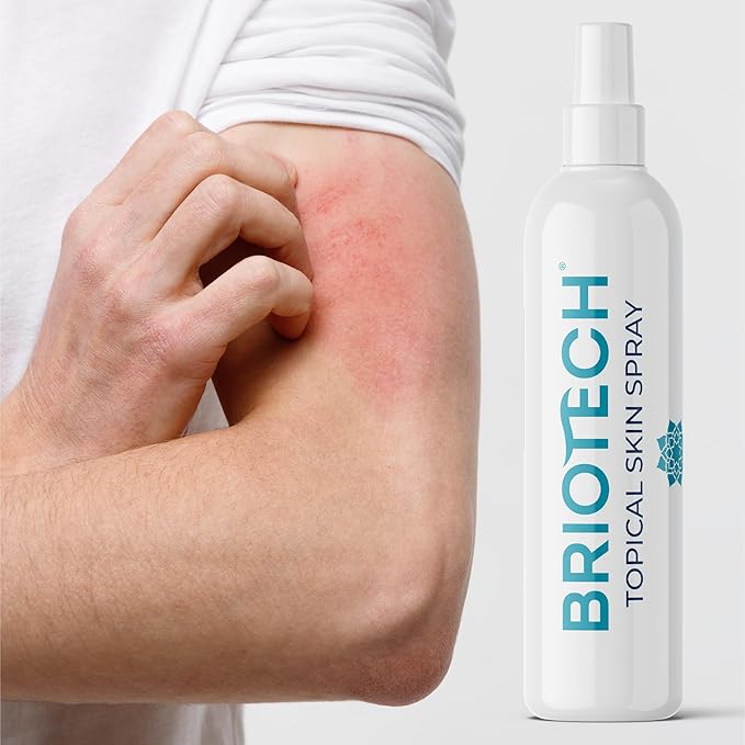 BRIOTECH Hypochlorous Acid Spray, Topical Skin Face & Body Mist, Support Irritations, Soothe Redness, Dry Skin & Scalp, Athletic Itch, Packaging May Vary