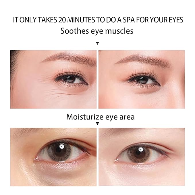 BLUE LOVE 40 Pcs Calendula Under Eye Patches - Rejuvenating Eye Mask for Reducing Puffiness, Dark Circles, and Wrinkles - Hydrating Treatment for Tired Eyes