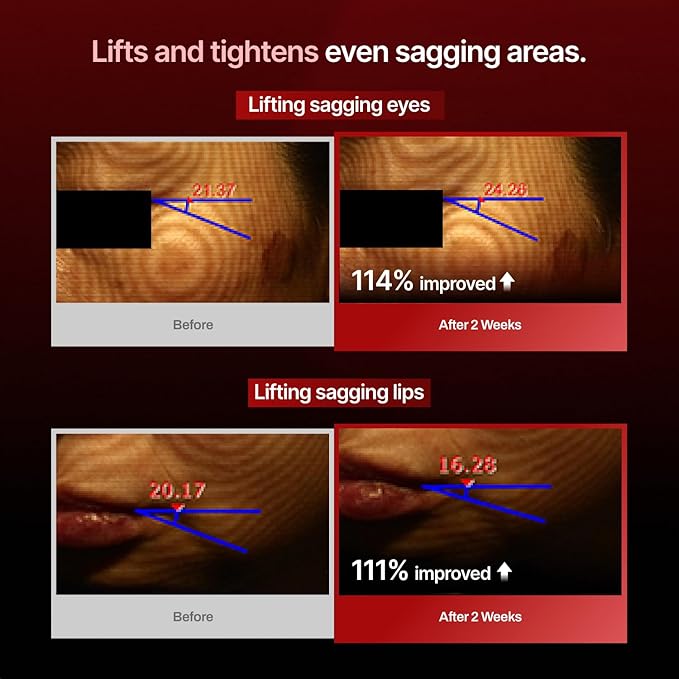 MEDITHERAPY Wrinkle fit Korean Mesh Sheet Masks (7EA), Collagen Mesh Sheet Mask for Glowing Skin, Daily Facial Mask, Hyaluronic acid Facial Mask, Korean Skincare