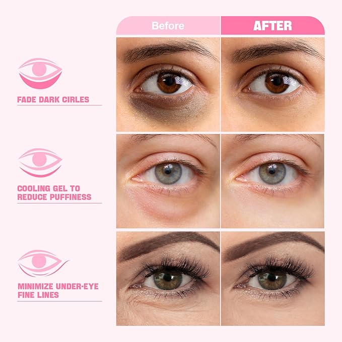 ZealSea Under Eye Patches for Puffy Eyes and Dark Circles (Collagen, 20pairs), Anti-wrinkle Patches, Eye Bags Remover for Women, Eye Masks-Pads-Gels for Spa Party Christmas Gifts, Vegan Cruelty-Free