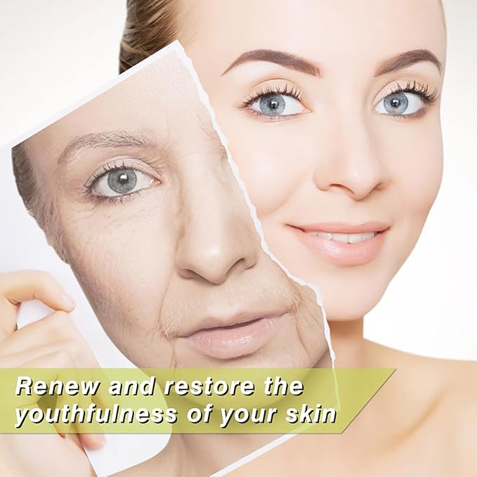 Elves Pdo Threads for Eyes Lift Mono Screw Type 30g25mm Pdo Lifting Thread for Fox Eye 40pcs Pdo Threads for Face Lift with Blunt Tips Smooting Eye Wrinkles Improves Skin's Firmness and Elasticity