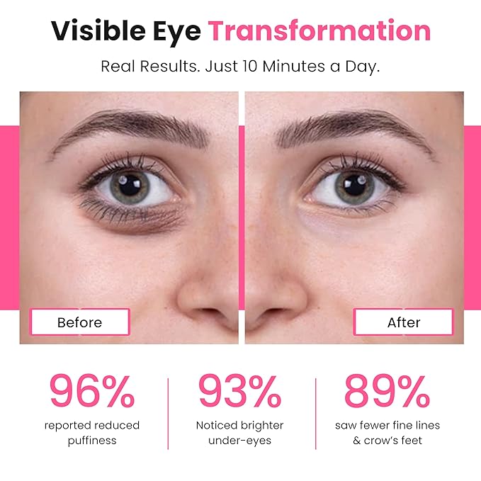 Eye Revitalize – Red Light Therapy for Dark Circles & Eye Bags