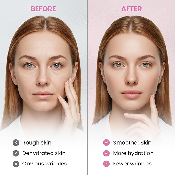 Anti Wrinkle Forehead and Facial Wrinkle Patches: Anti Wrinkle Patches Overnight - Smile Line Pathces - Facial Wrinkle Patche for Forehead, Smile Line, Under Eye 144 Pcs (Purple1)