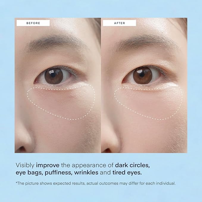 Under Eye Patches for Dark Circles: Puffiness & Eye Bag Treatment Gel Mask with Caffeine Hyaluronic Acid Niacinamide - Undereye Brightening Hydrating Anti-Wrinkle & Cooling - Korean Skincare, 30 Pairs