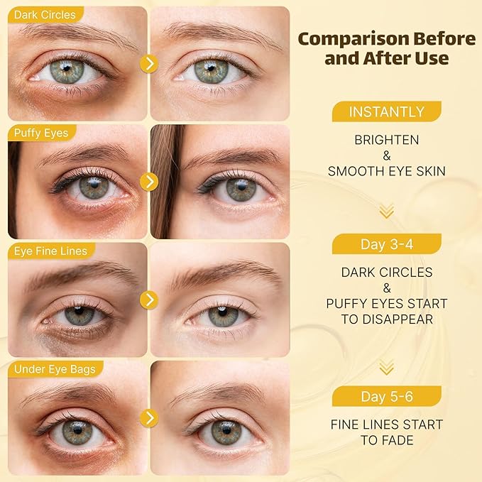 Under Eye Patches - Eye Mask for Puffy Eyes and Dark Circles, Eye Patches with Hyaluronic Acid & Collagen to Reduce Wrinkles and Relieve Pressure (20 Pairs)