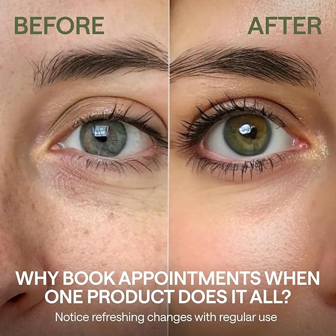 Eye Cream with Caffeine - Hyaluronic Acid and Niacinamide Serum - Face Puffiness Reducer