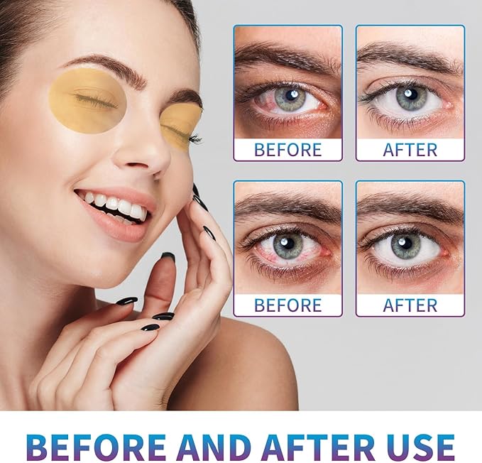 Eye Care Patch 20PCS Eye Pads for Tired Eyes & Dry Eyes Eye Cooling Pads for Puffy Eyes, Office Eye Relief & Refresh Refresh and Revitalize Tired Eyes