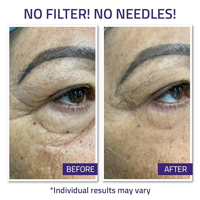 YEOUTH Instant Face Lift Cream, Temporary Skin Tightening Under Eye Cream for Women, Tightening and Lifting Concealer 15ml