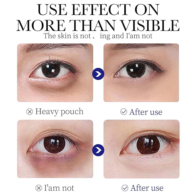 Q.Z.Art Revitalizing Eye Cream with Hyaluronic Acid & Collagen | Hydrates, Includes Soothing Ice Roller