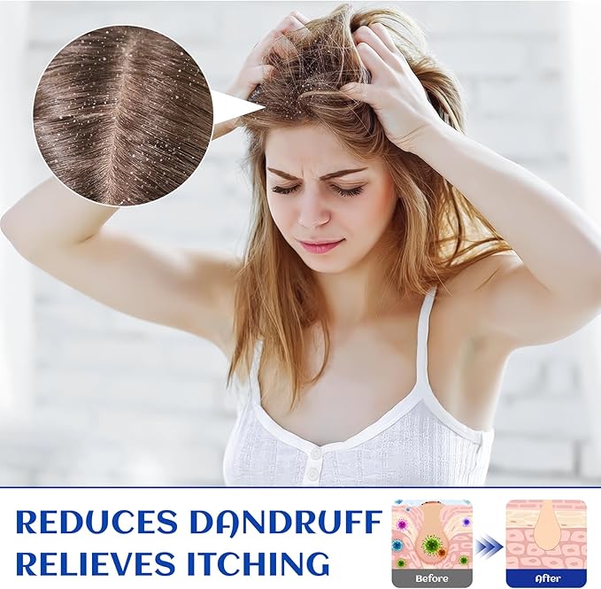 HIQILI 1000ML Rosemary Oil for Hair Growth, Add to Shampoo & Conditioner, 100% Pure Undiluted - 32 Fl Oz